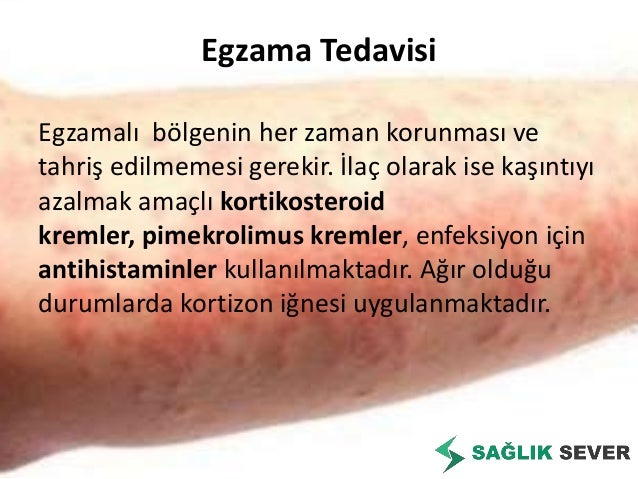 Konfokal nedir - İnternet imkânlarını inceliyoruz 2